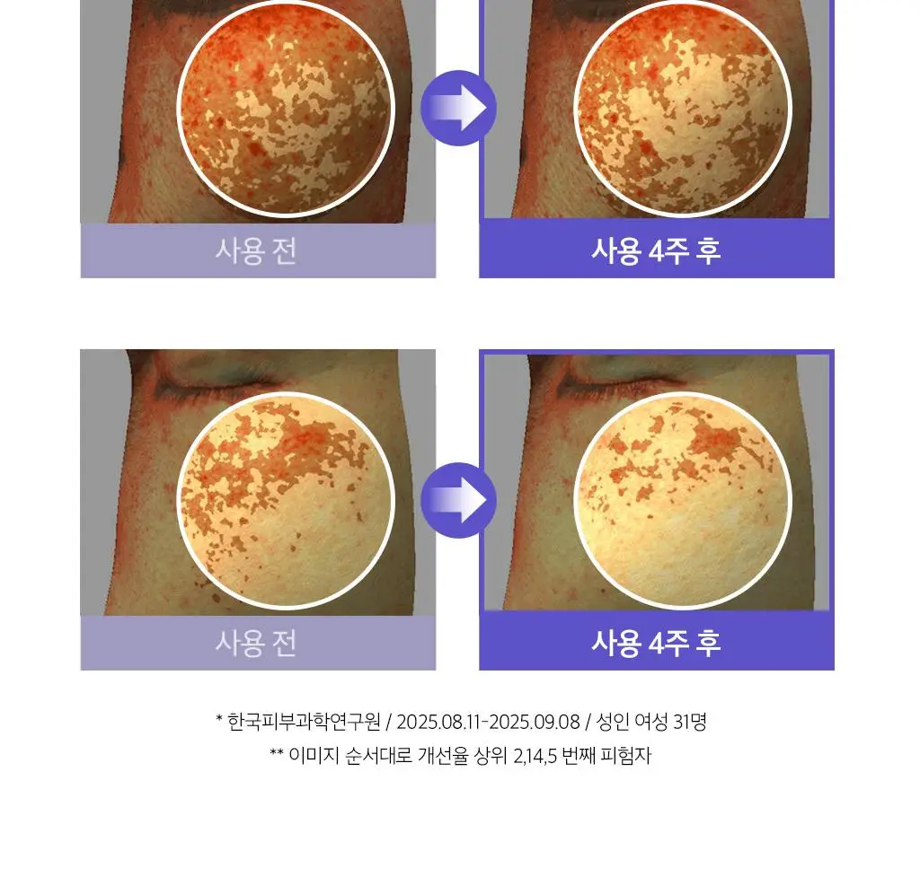 [이달의신상] 오휘 기미케어 3-STEP 콜라겐 톤업선 50ml / 데니어 팩트 리필 기획 / 멜라토닝 크림 60ml 상세페이지 8